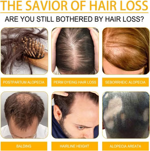 OUHOE Biotin Hair Growth Serum – Stronger & Healthier Hair سيروم OUHOE بالبيوتين لنمو الشعر – شعر أقوى وأكثر صحة